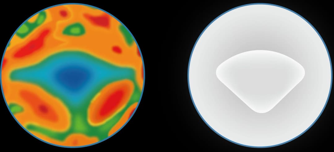 远视储备不足临床观察曲线