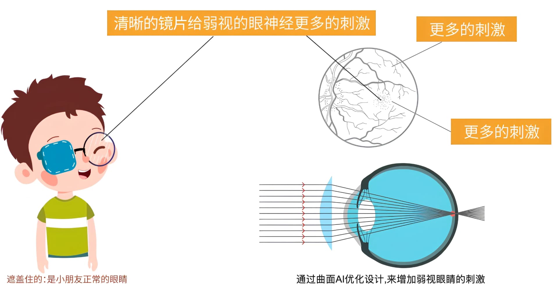 未睐瞳远视(弱视)专用镜片占位图